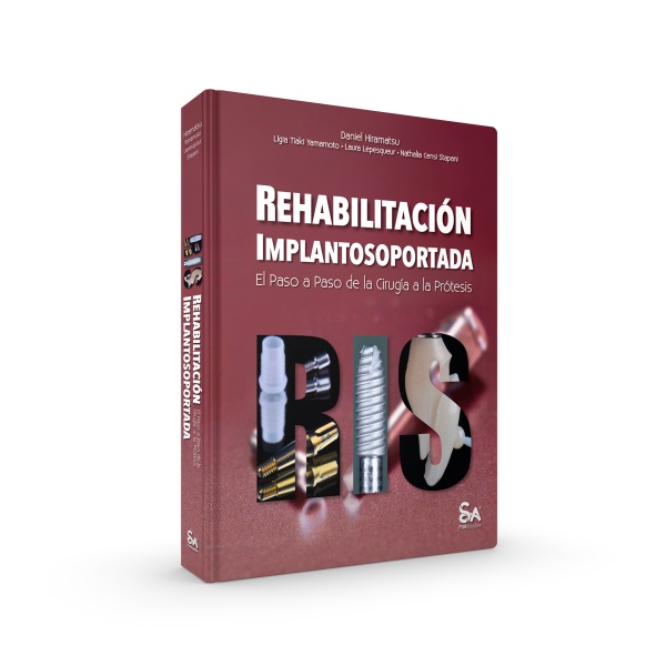 REHABILITACIÓN IMPLANTOSOPORTADA El Paso a Paso de la Cirugía a la Prótesis
